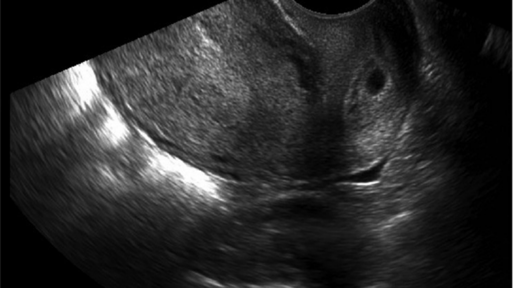 Stock image of Ultrasound
